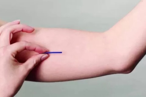 Araruama inicia oferta de implante contraceptivo na rede municipal de saúde